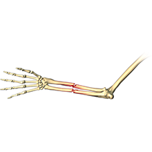 Adult Forearm Fractures