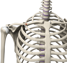 Clavicle Fracture